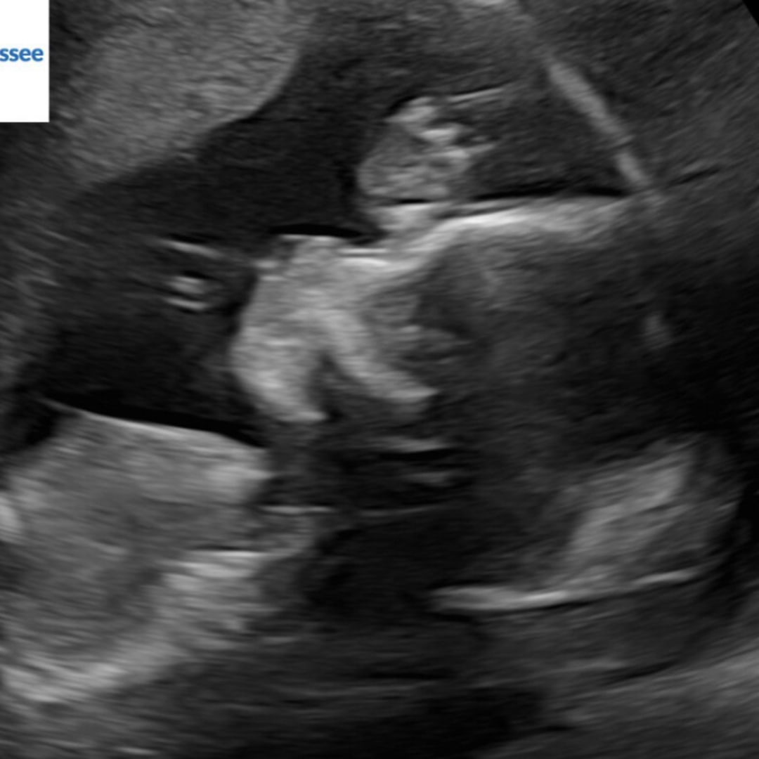 Photo shared by Lillie for their Babylist baby registry.