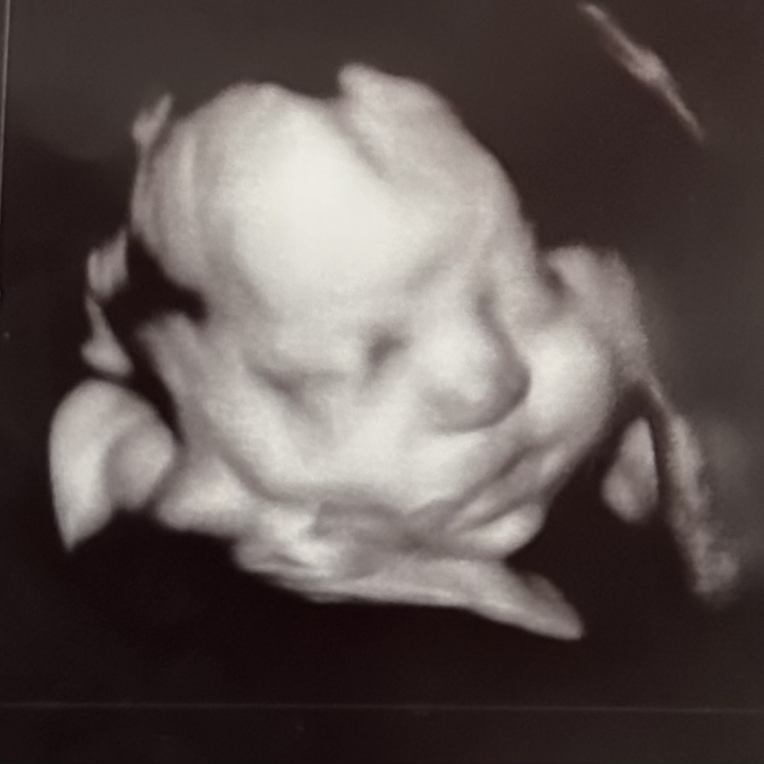 Photo shared by Jacqueline for their Babylist baby registry.