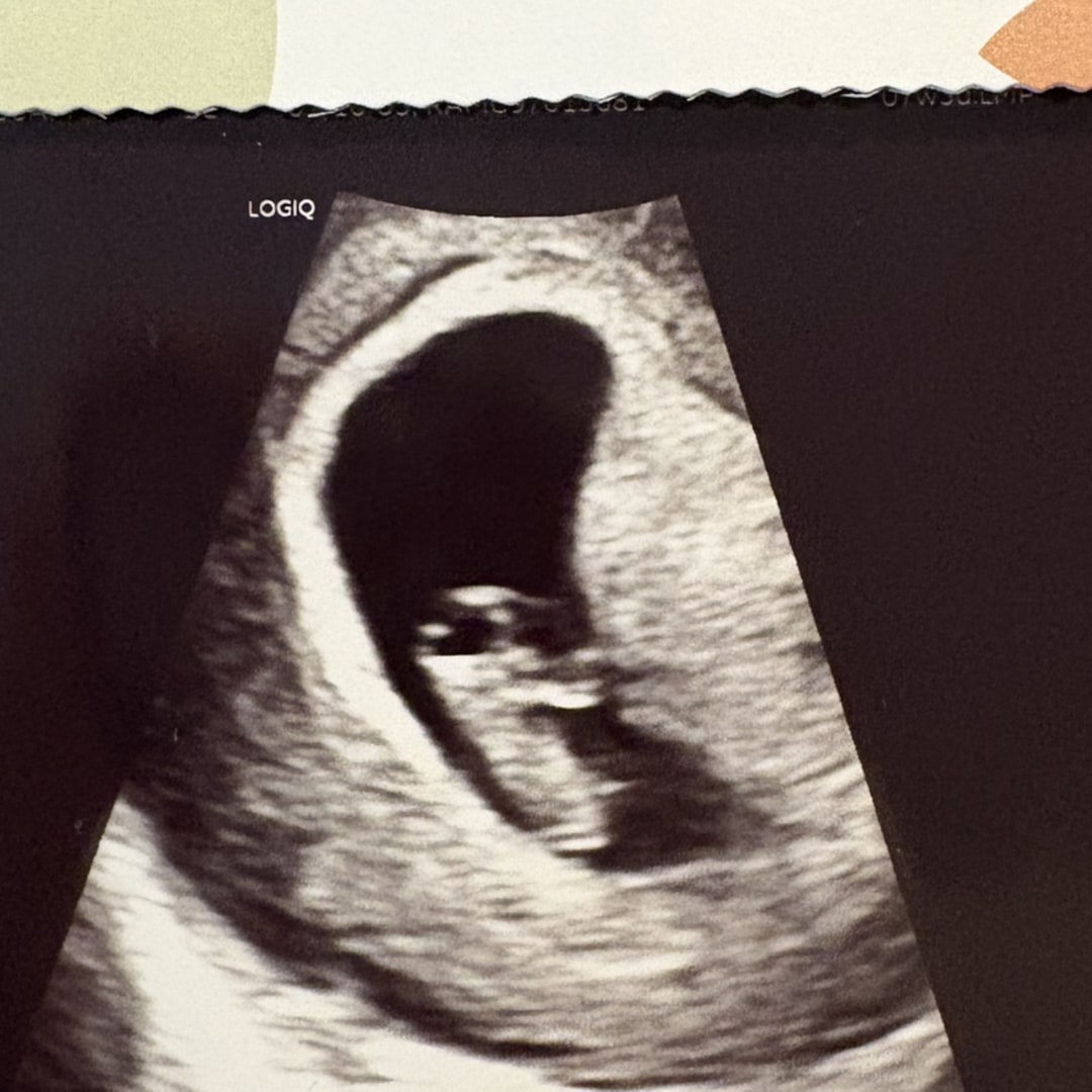 Photo shared by Jazmine for their Babylist baby registry.