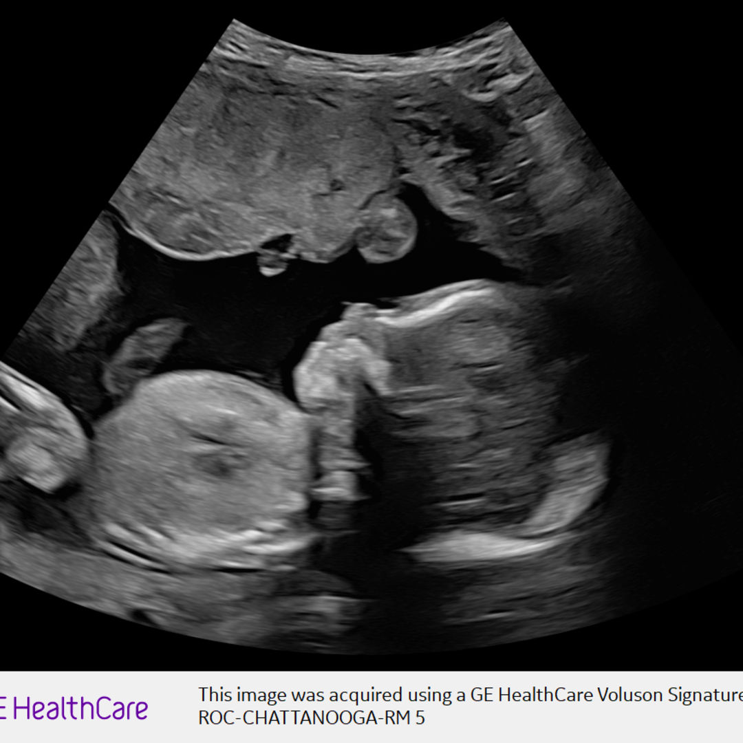 Photo shared by Jenifer & Taylor for their Babylist baby registry.