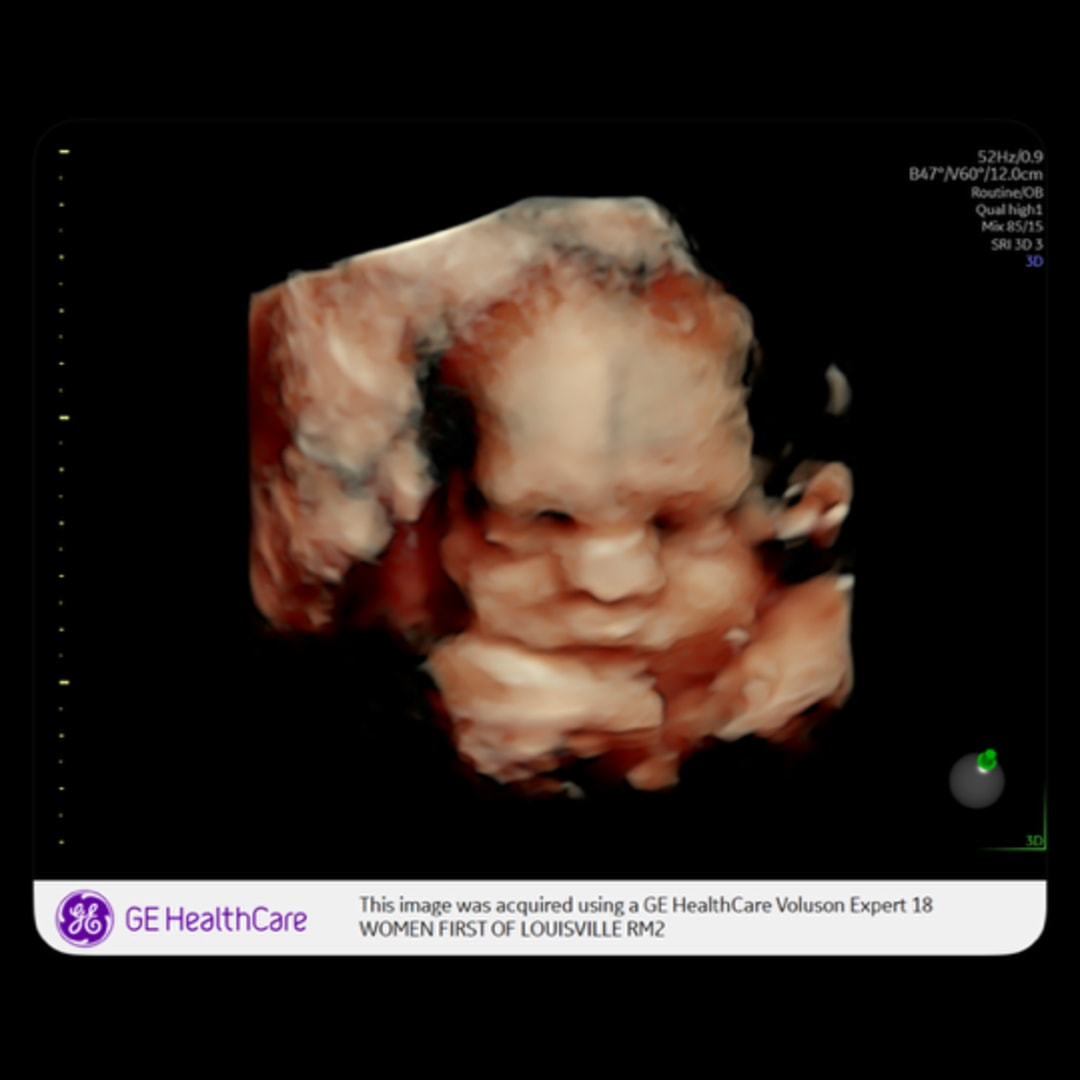 Photo shared by Michal for their Babylist baby registry.