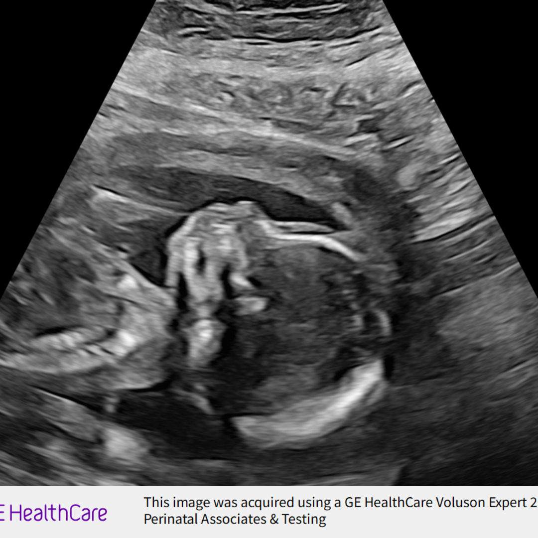 Photo shared by Abigail for their Babylist baby registry.