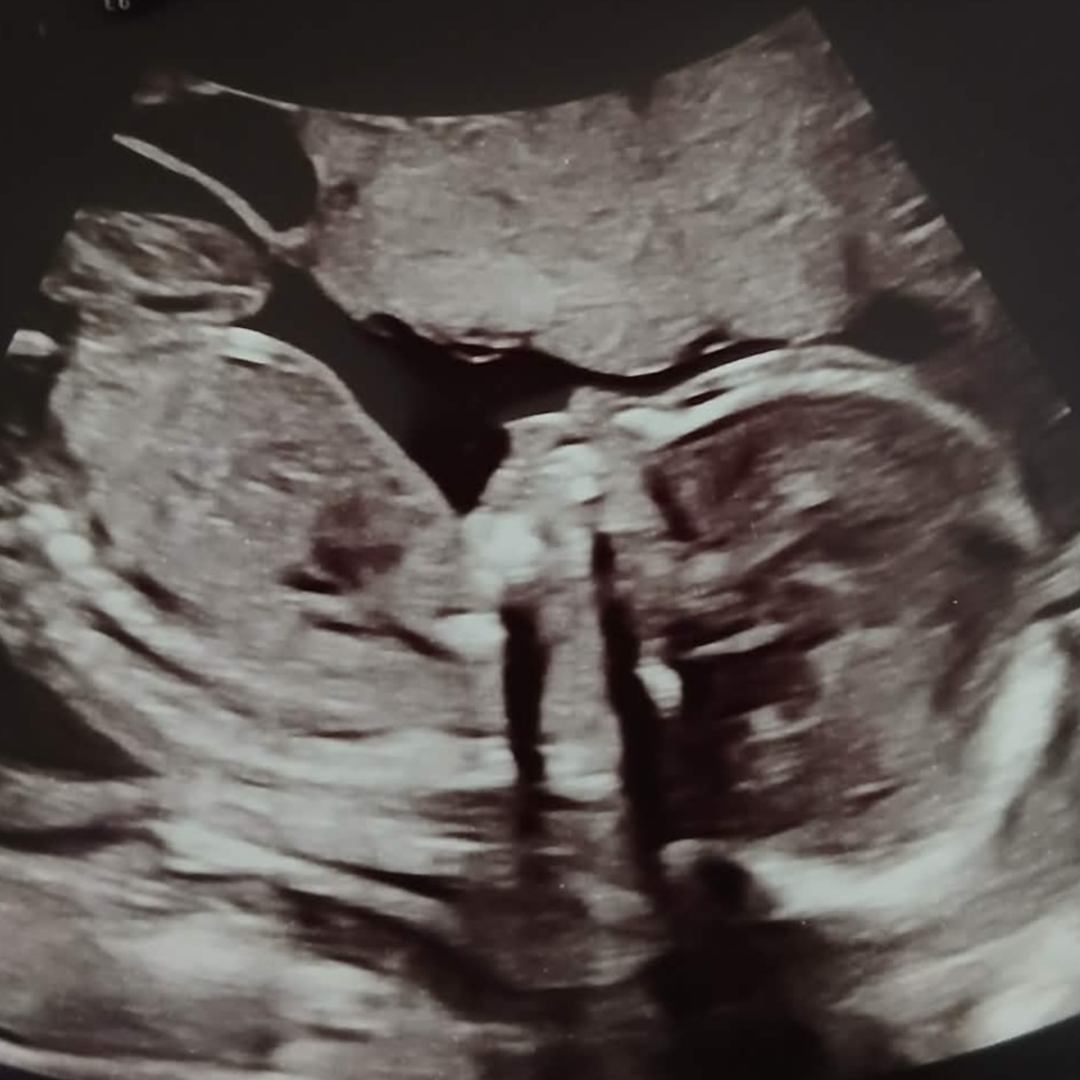 Photo shared by Rachael for their Babylist baby registry.