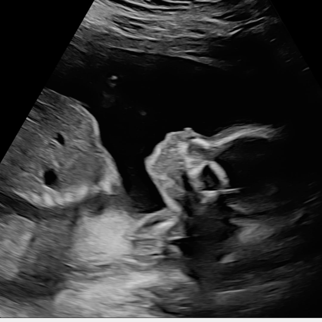 Photo shared by Gabriela for their Babylist baby registry.