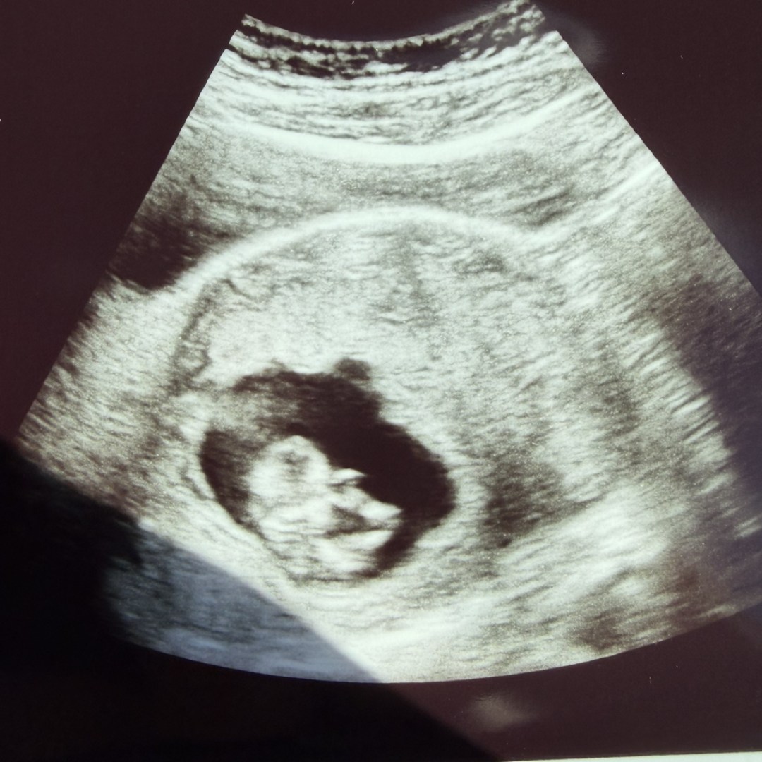 Photo shared by Abby for their Babylist baby registry.