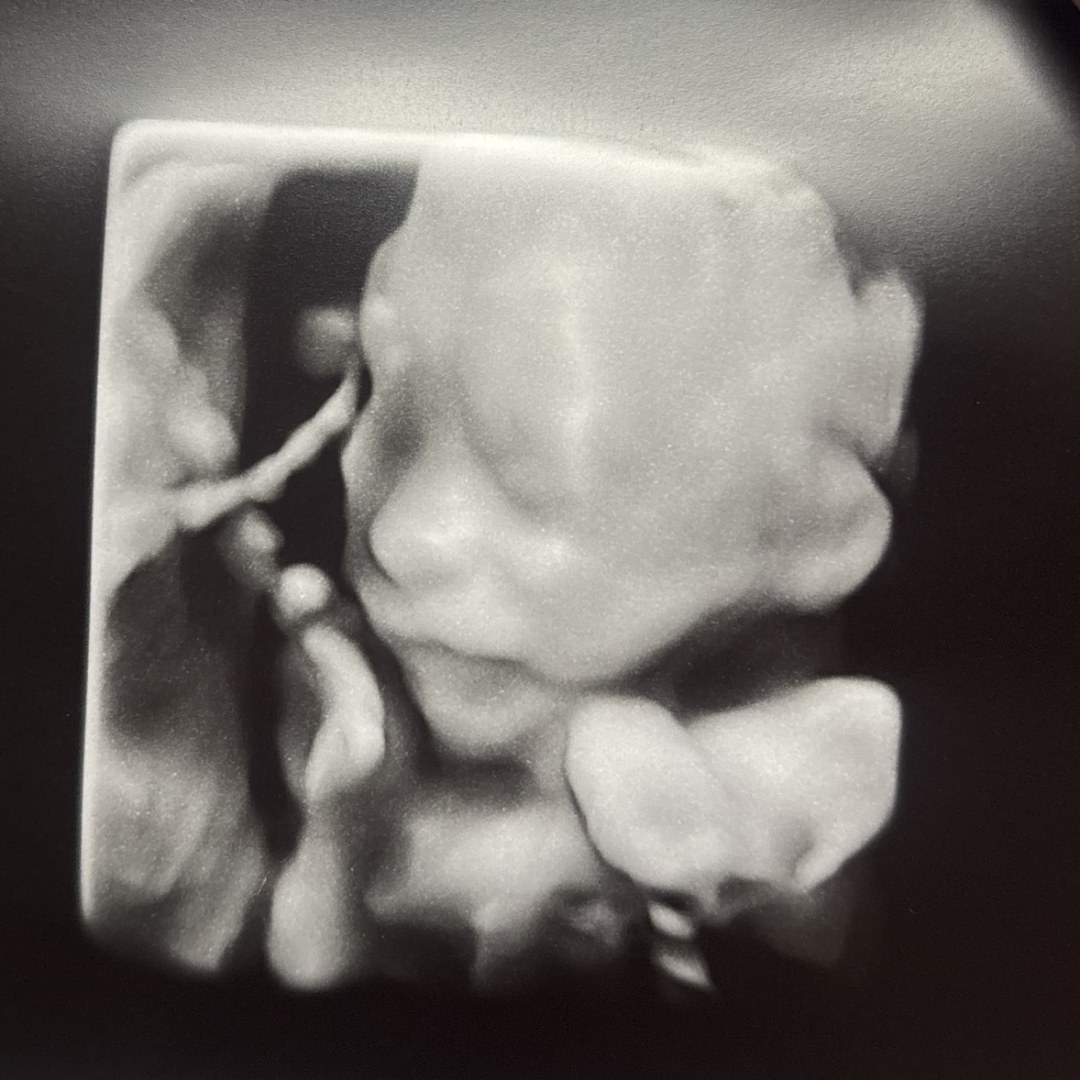 Photo shared by Kali for their Babylist baby registry.