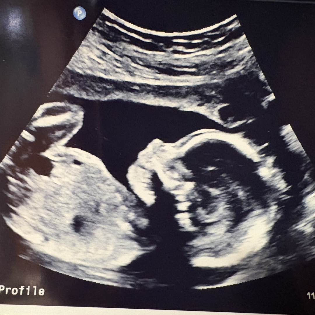 Photo shared by Abigail for their Babylist baby registry.