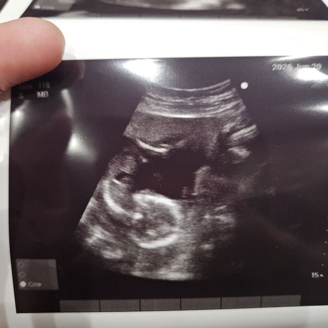 Photo shared by Brianna for their Babylist baby registry.