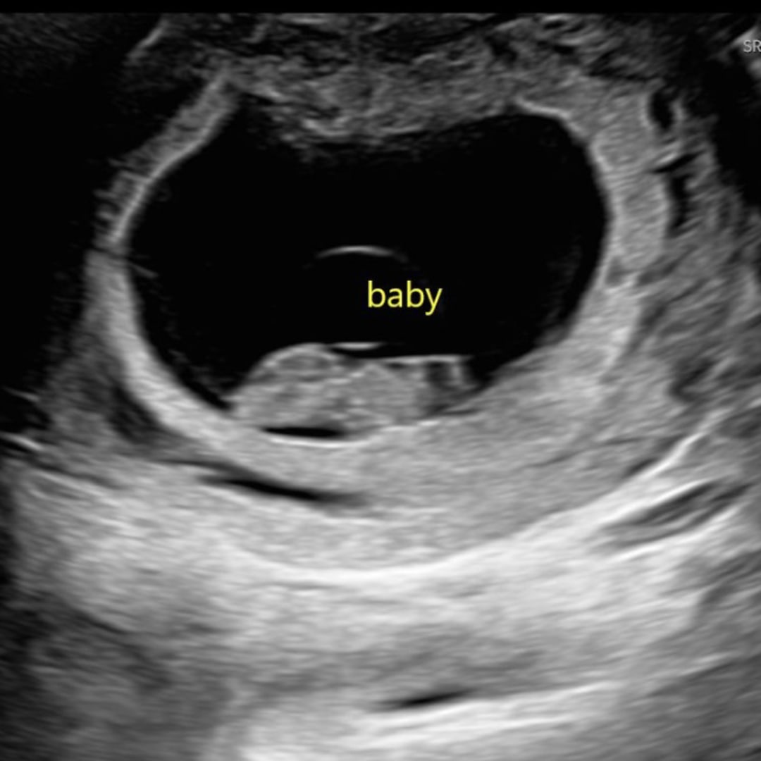 Photo shared by Ashley for their Babylist baby registry.