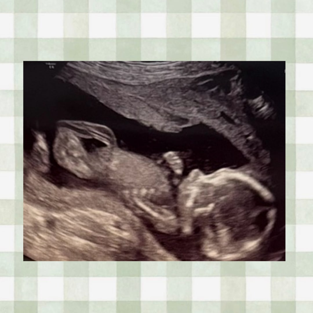 Photo shared by Colleena for their Babylist baby registry.
