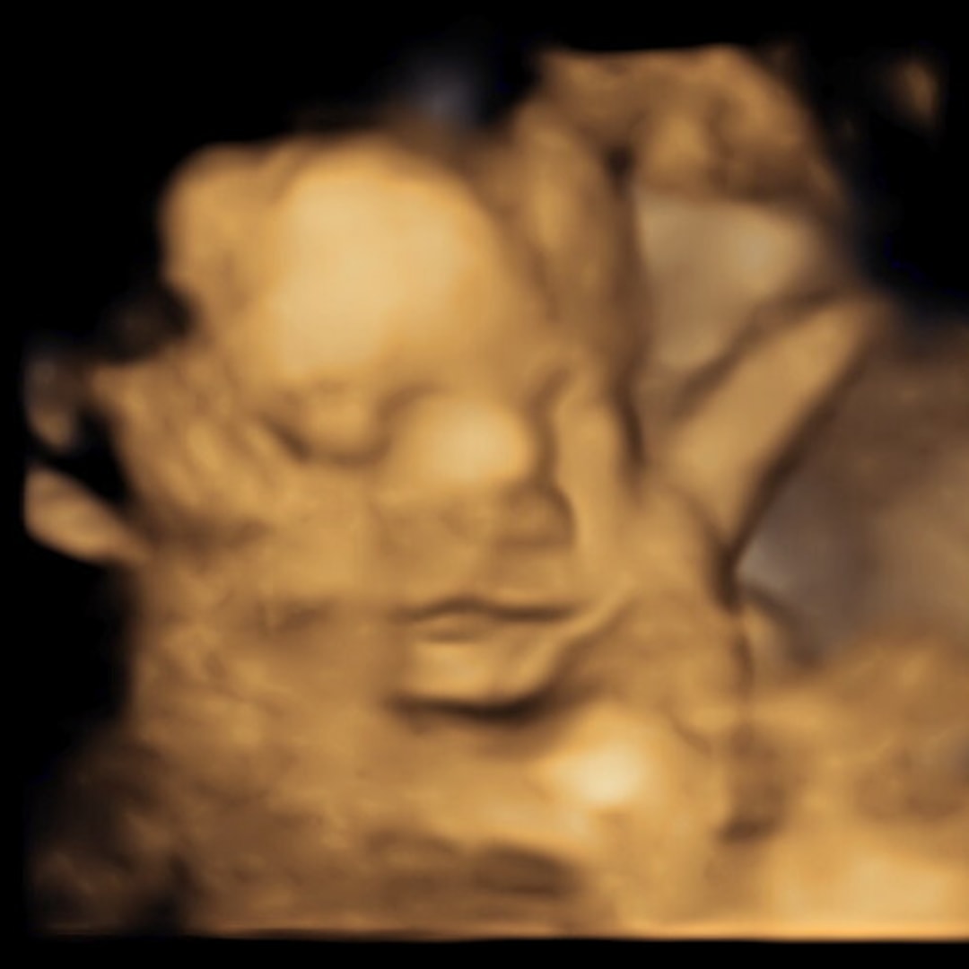 Photo shared by Brynn for their Babylist baby registry.