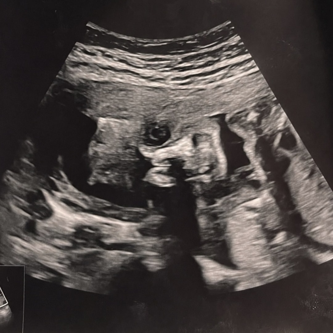 Photo shared by Paige for their Babylist baby registry.