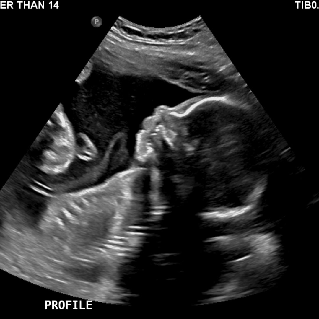 Photo shared by Moriah and Paul for their Babylist baby registry.