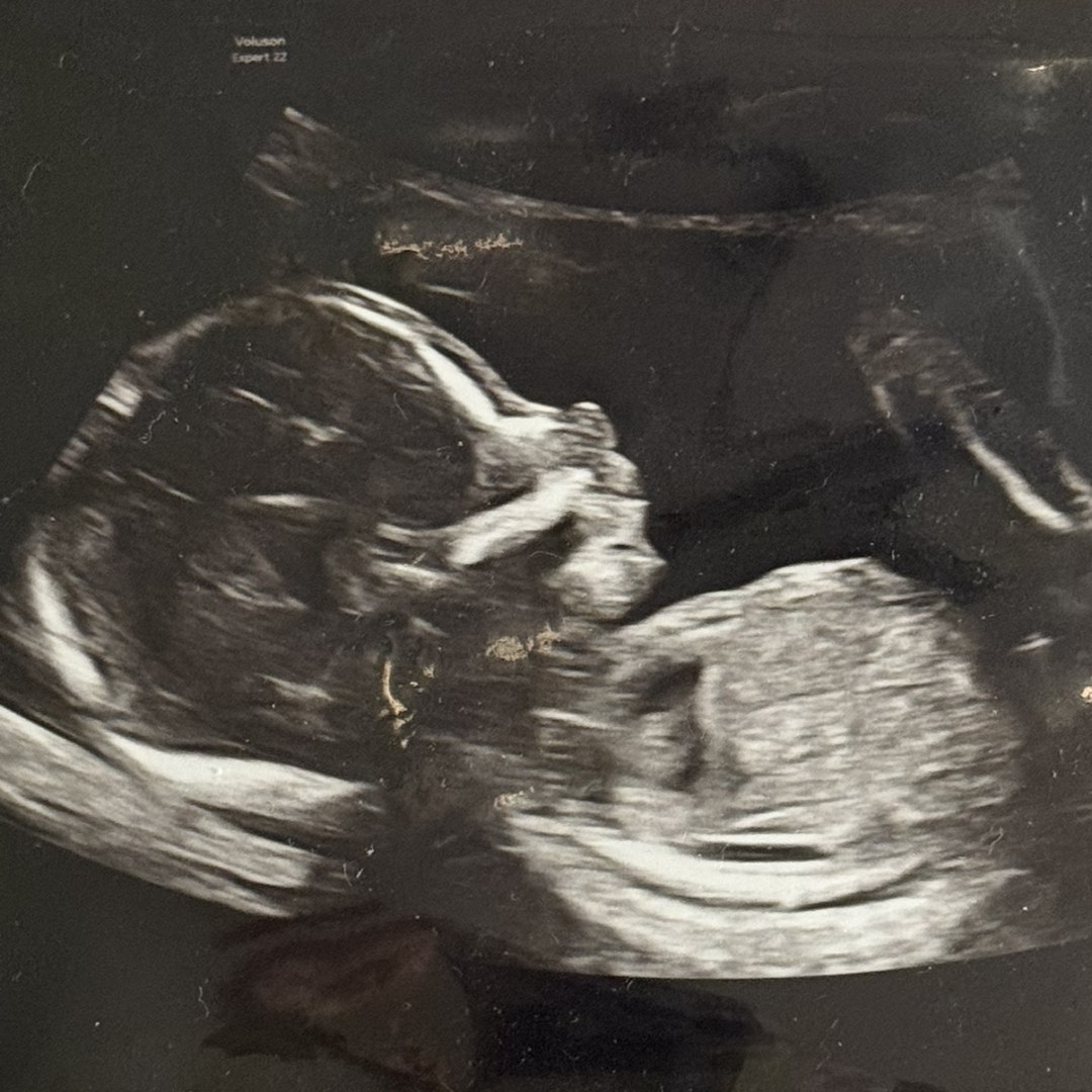 Photo shared by Natalie for their Babylist baby registry.