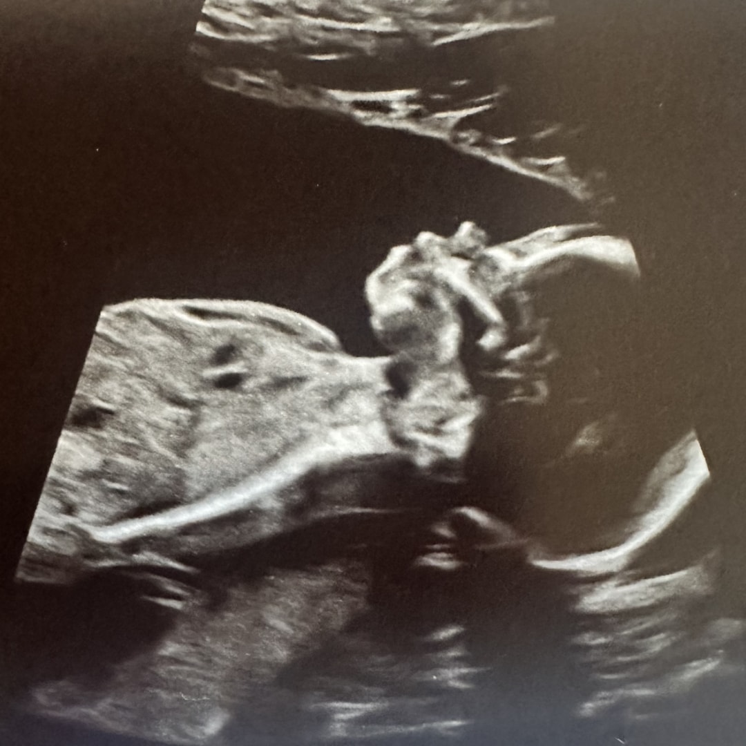 Photo shared by Gel for their Babylist baby registry.