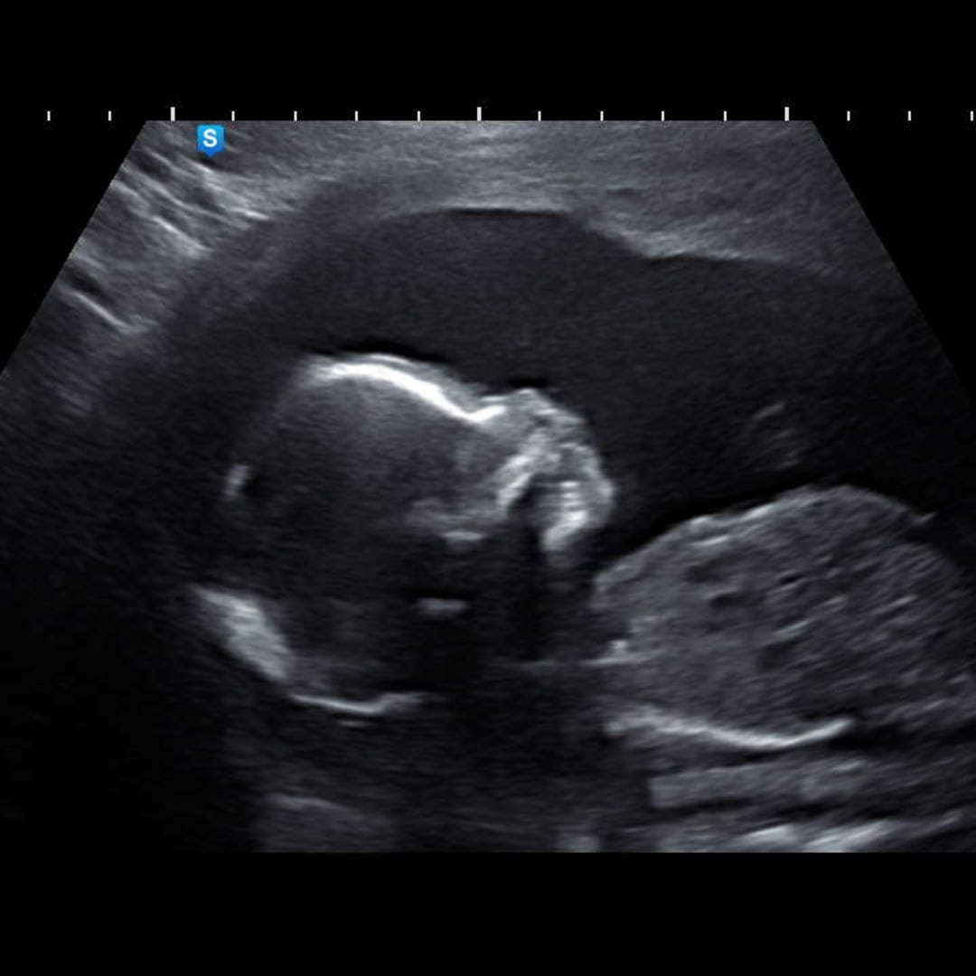 Photo shared by Seanise for their Babylist baby registry.