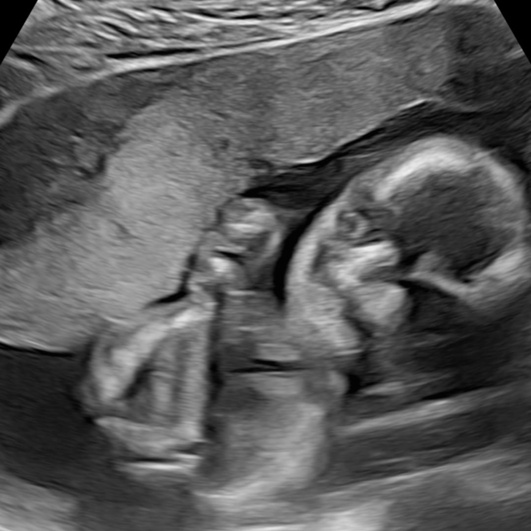 Photo shared by Sarah for their Babylist baby registry.