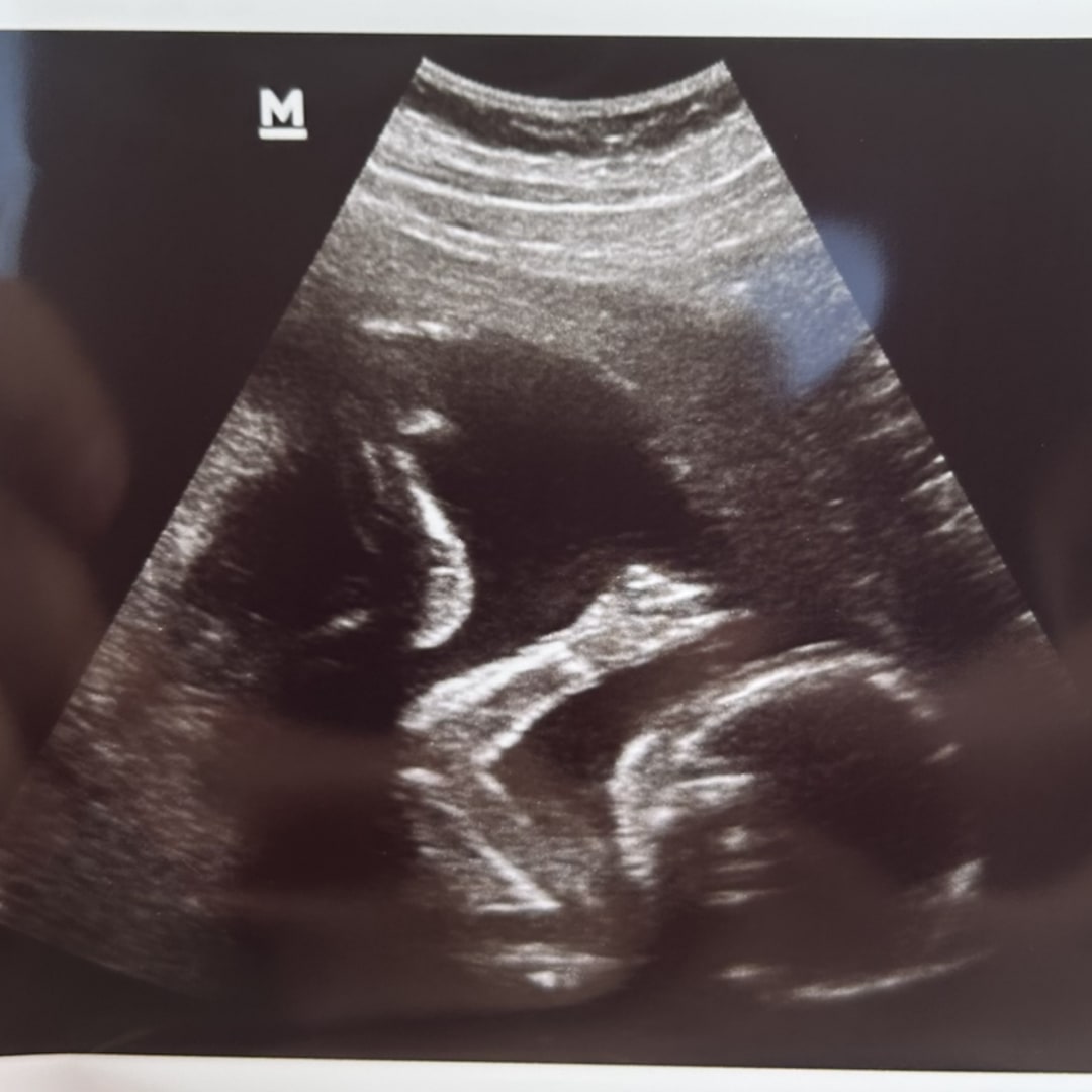 Photo shared by Rachel for their Babylist baby registry.