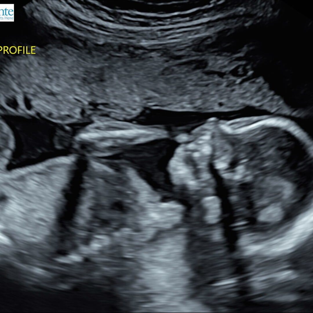Photo shared by Harley for their Babylist baby registry.