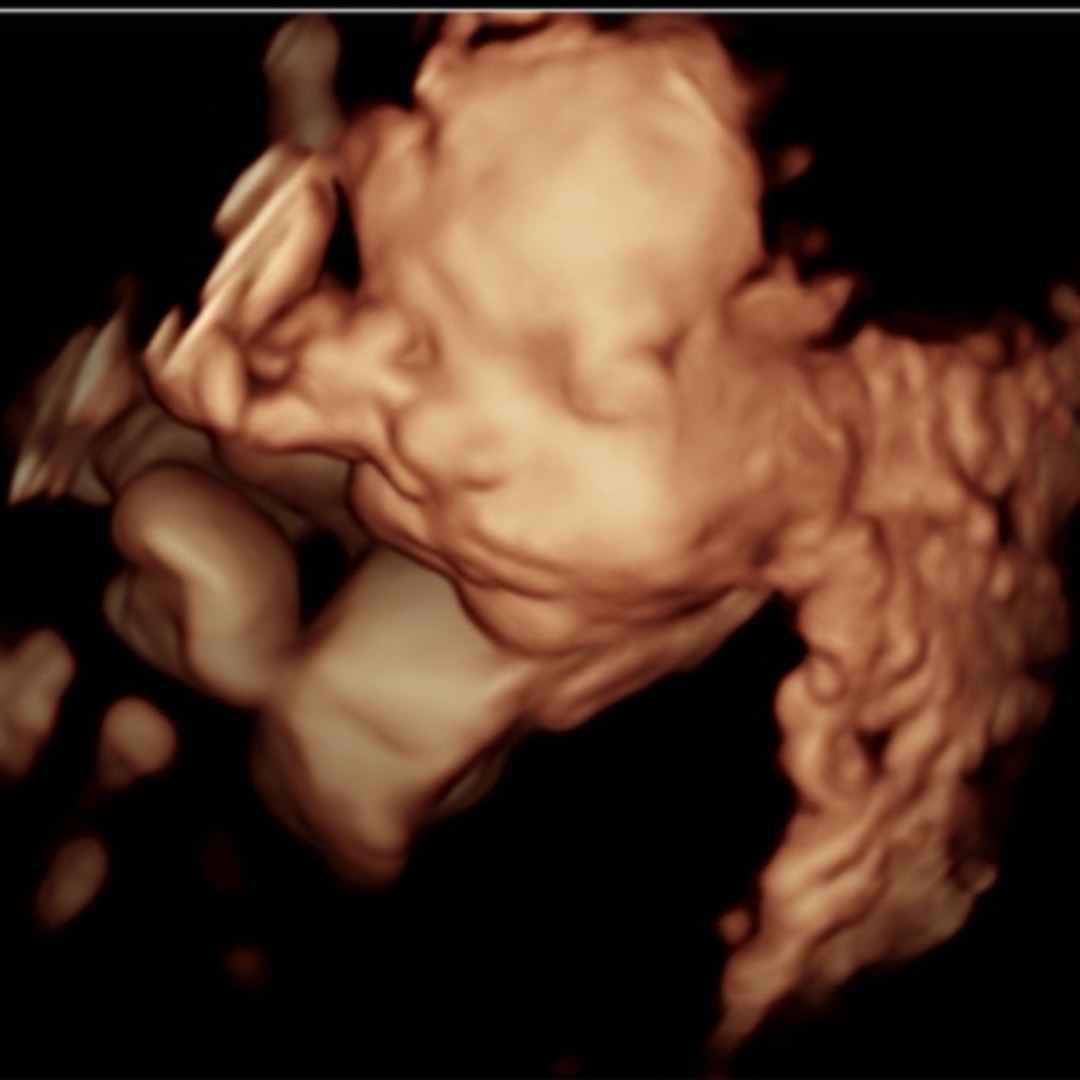 Photo shared by Kalee for their Babylist baby registry.