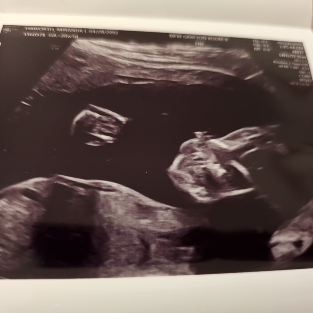 Photo shared by Miranda for their Babylist baby registry.