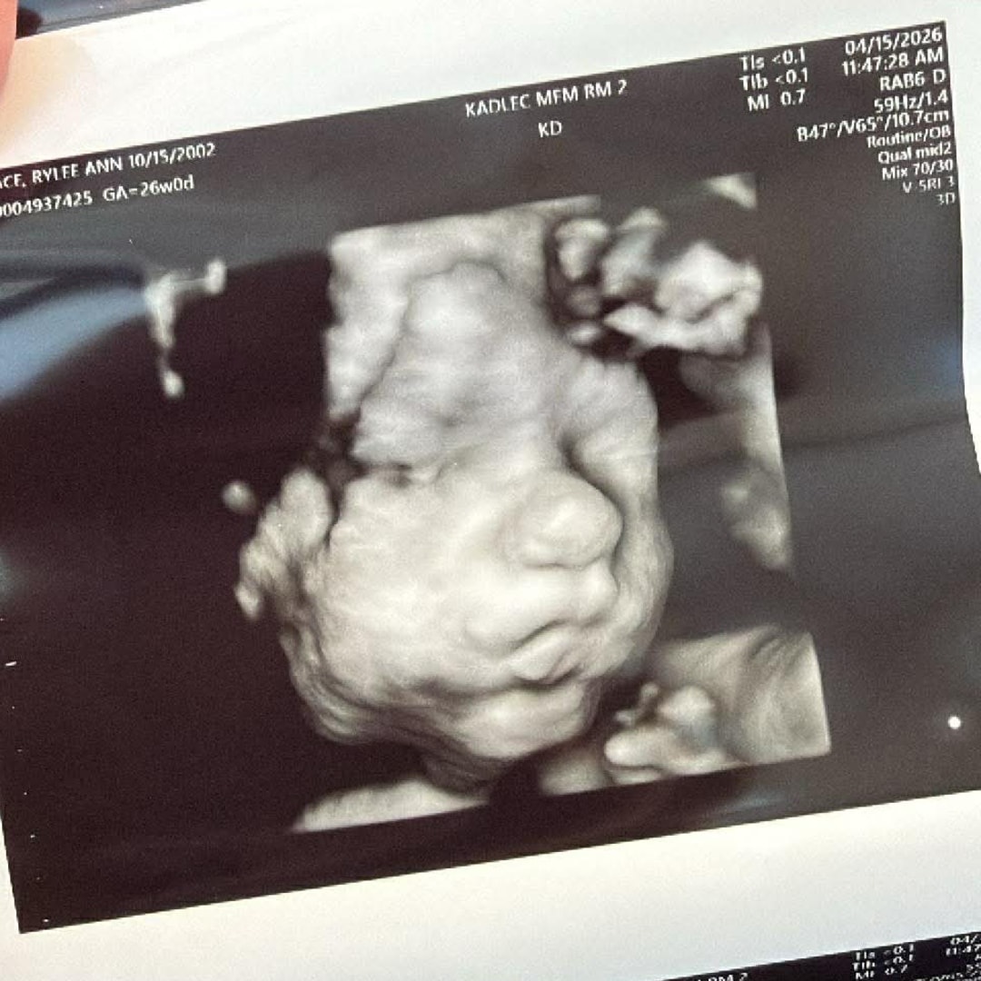 Photo shared by Rylee for their Babylist baby registry.