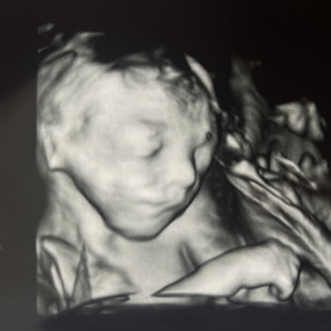 Photo shared by Rachael for their Babylist baby registry.