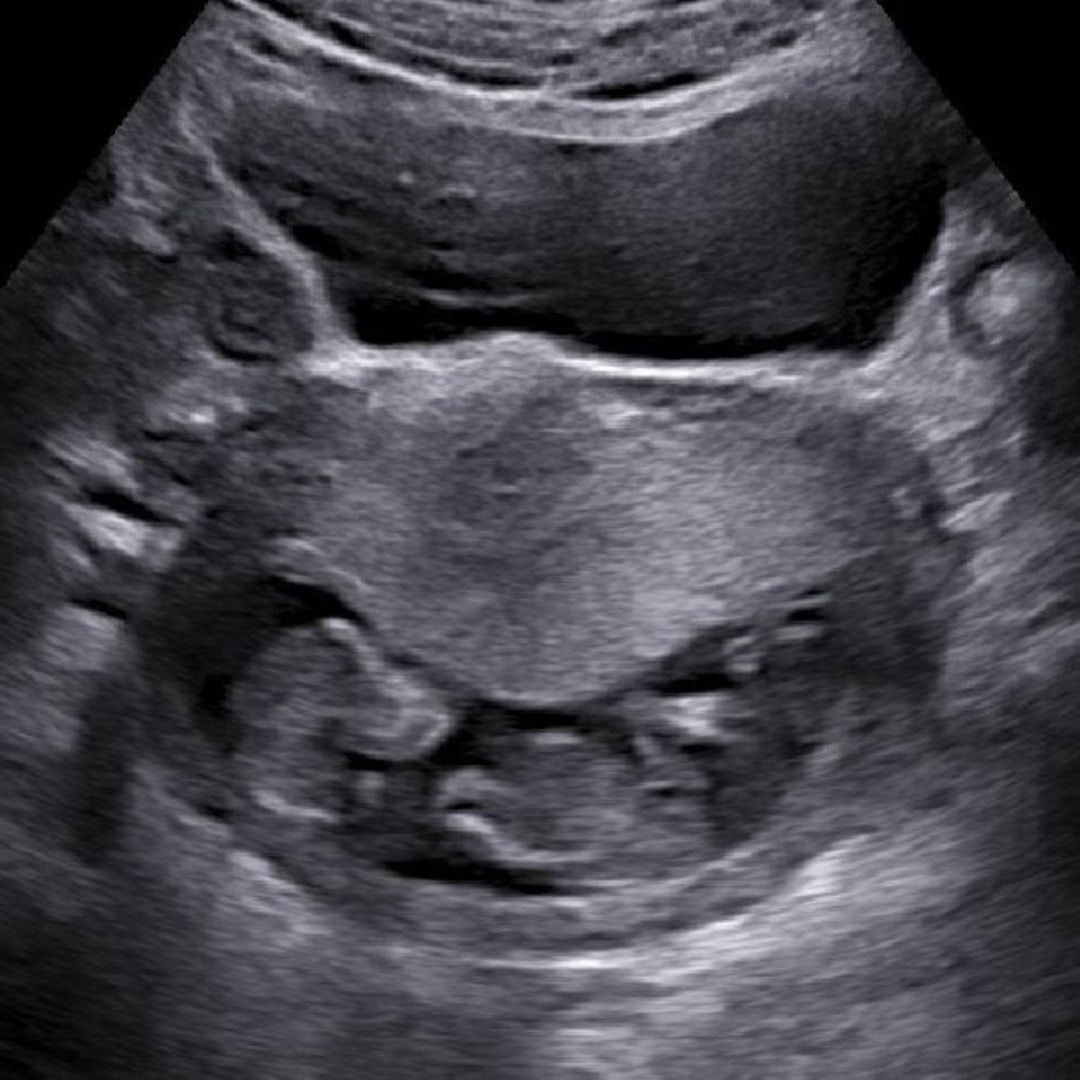 Photo shared by Shaina for their Babylist baby registry.