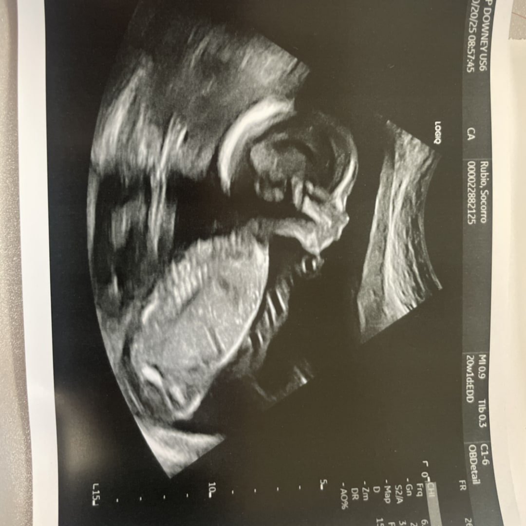 Photo shared by Socorro for their Babylist baby registry.