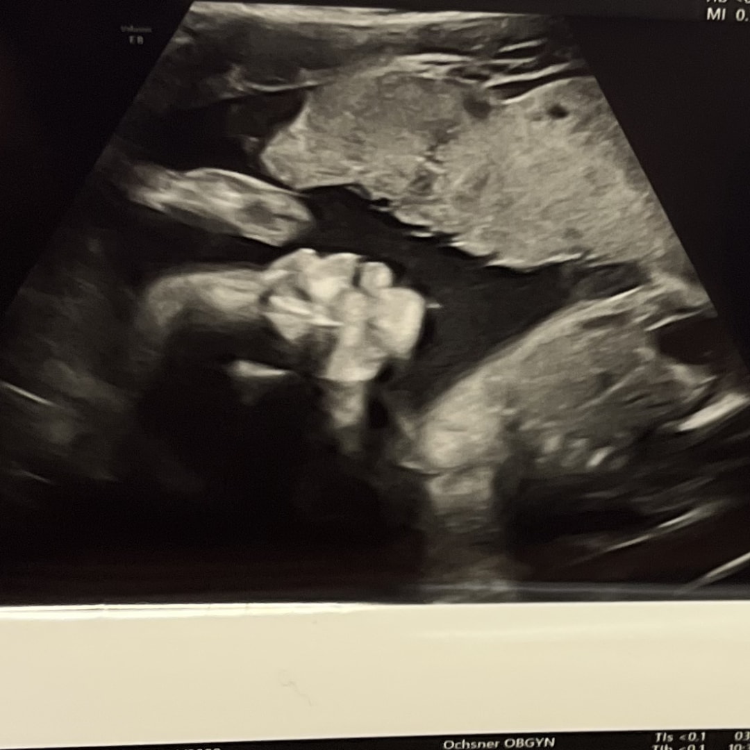 Photo shared by Niema for their Babylist baby registry.