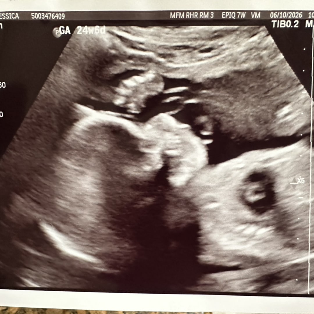 Photo shared by Jessica for their Babylist baby registry.