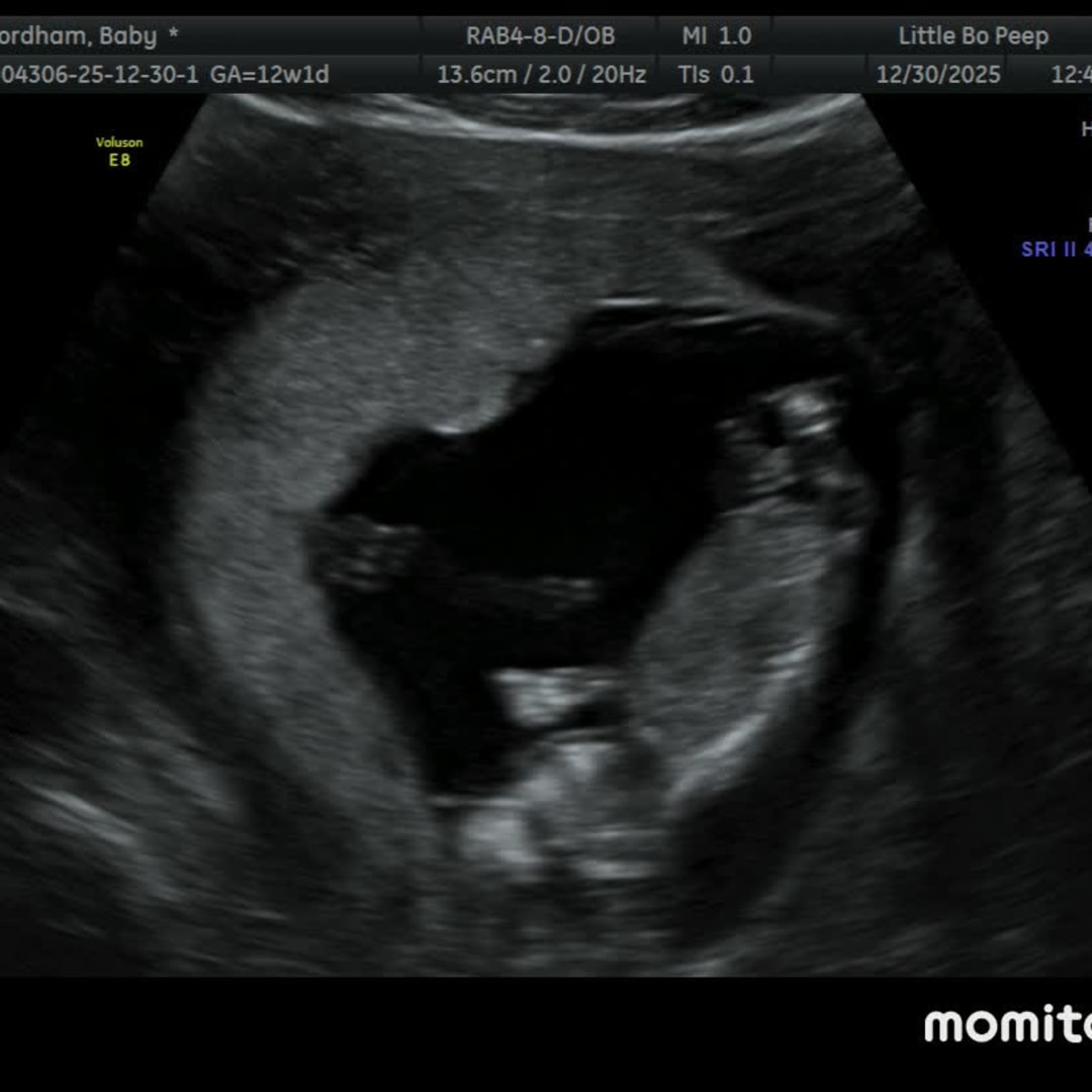 Photo shared by Dreanne for their Babylist baby registry.