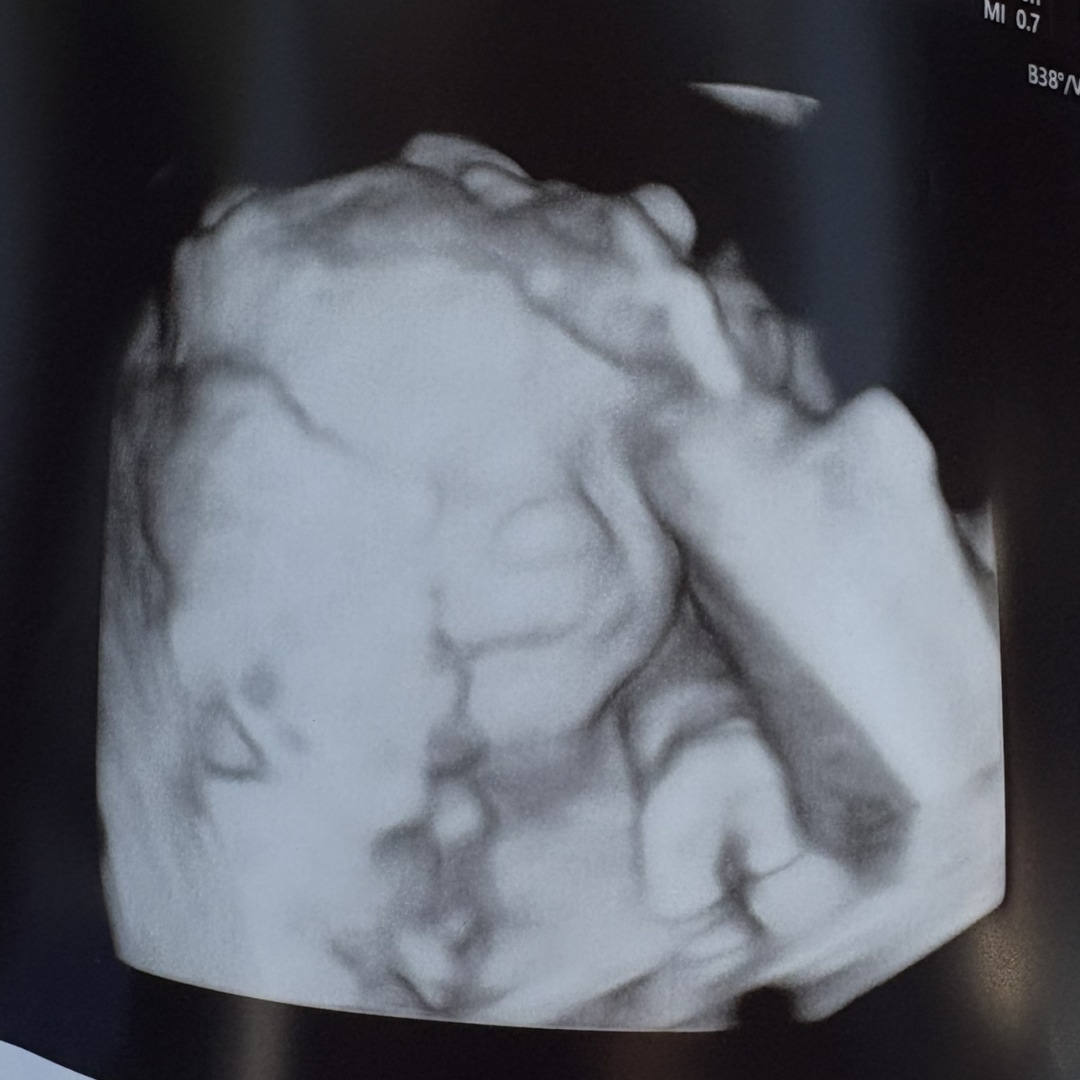 Photo shared by Haley for their Babylist baby registry.
