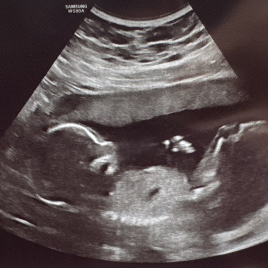 Photo shared by Christina for their Babylist baby registry.