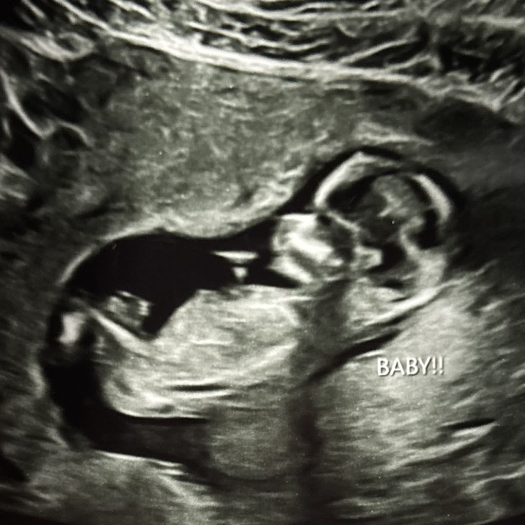 Photo shared by Jerrika for their Babylist baby registry.