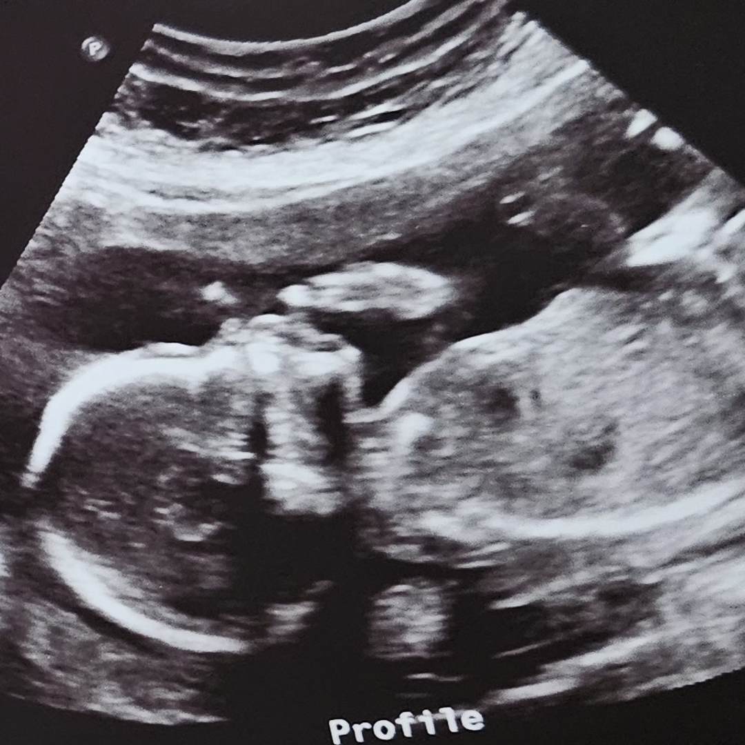 Photo shared by Alexandria for their Babylist baby registry.