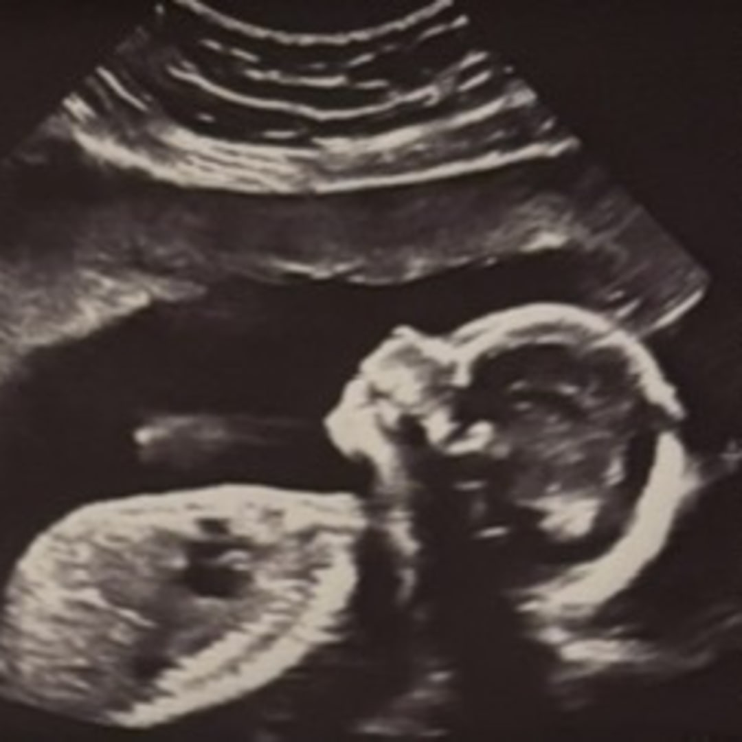 Photo shared by Lexi for their Babylist baby registry.