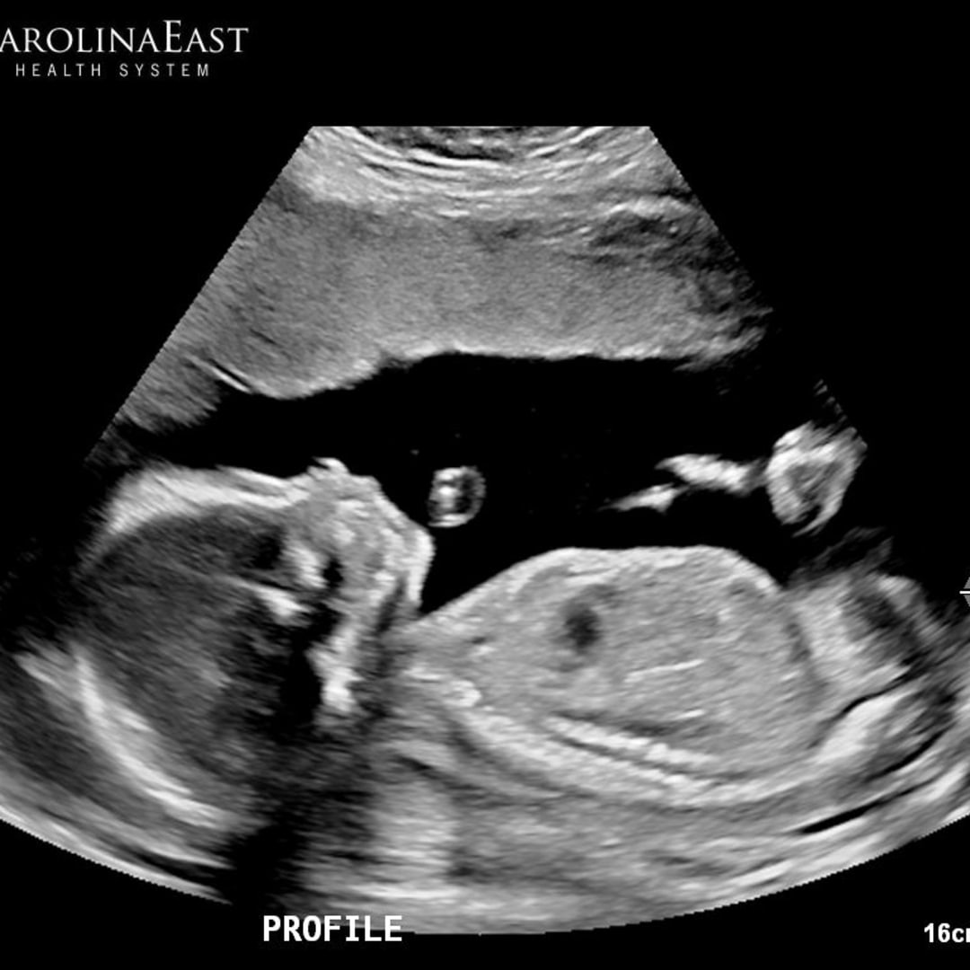 Photo shared by Karla for their Babylist baby registry.