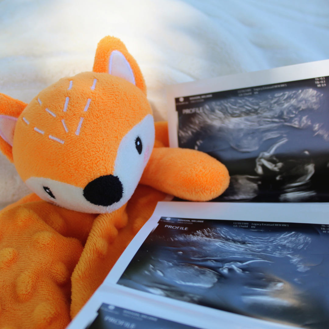 Photo shared by Melanie & Seth for their Babylist baby registry.
