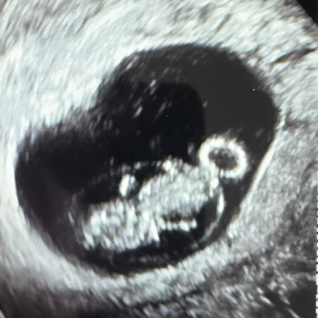 Photo shared by Kailey for their Babylist baby registry.