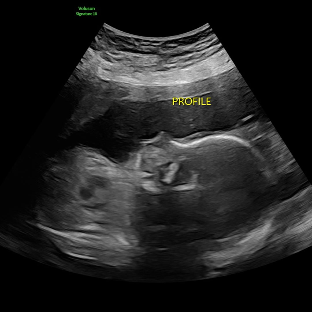 Photo shared by Jessica for their Babylist baby registry.