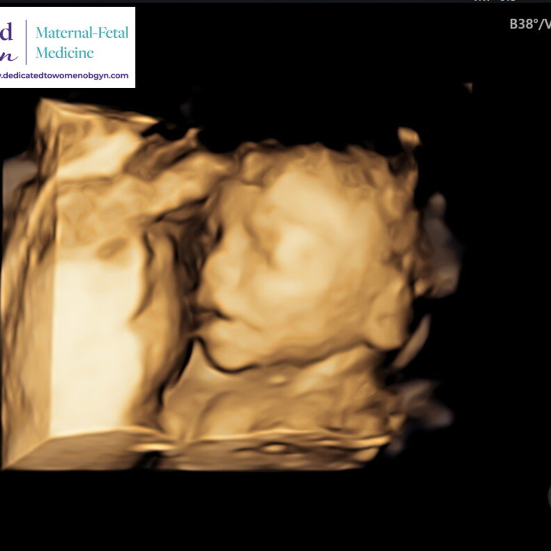 Photo shared by Heather for their Babylist baby registry.