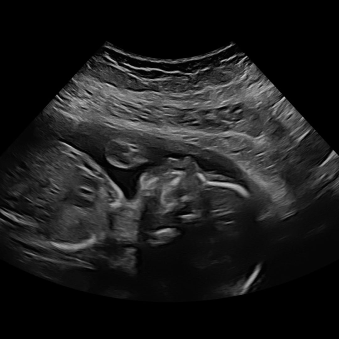 Photo shared by Alexandra for their Babylist baby registry.