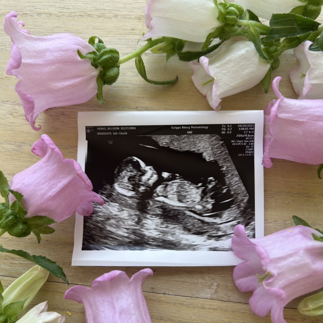 Photo shared by Allison for their Babylist baby registry.