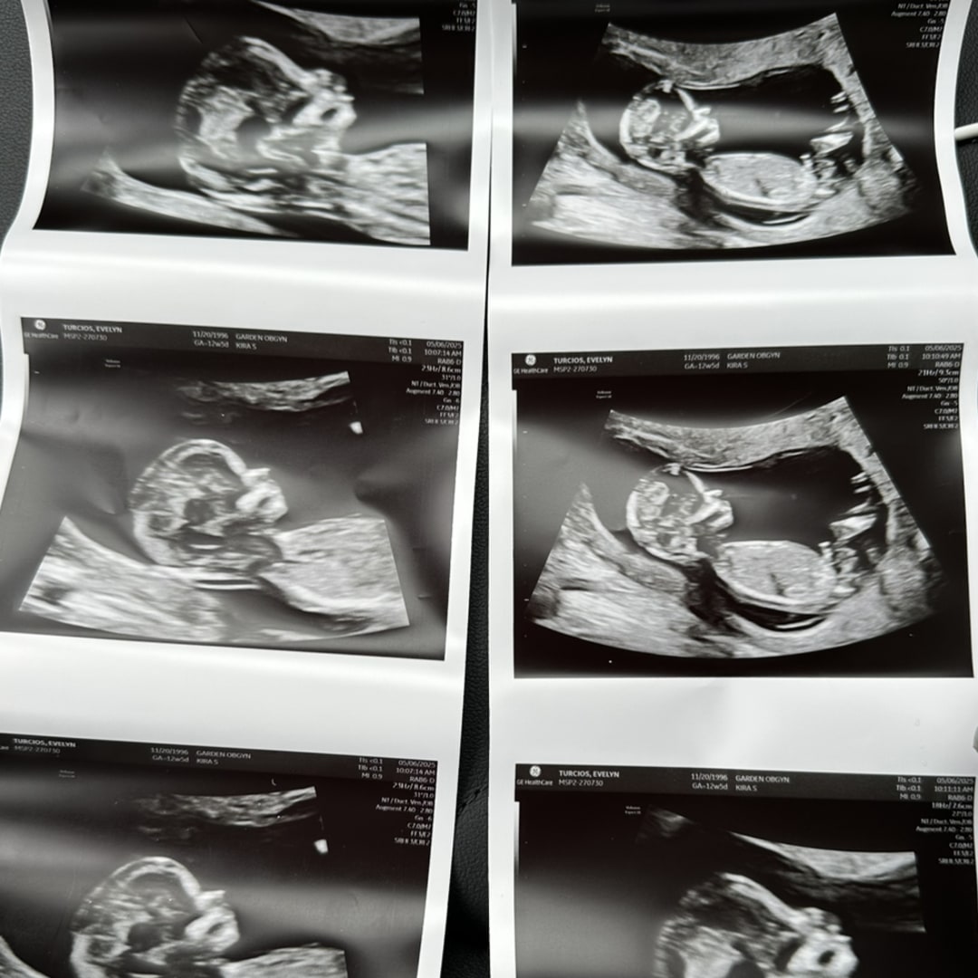 Photo shared by Evelyn for their Babylist baby registry.