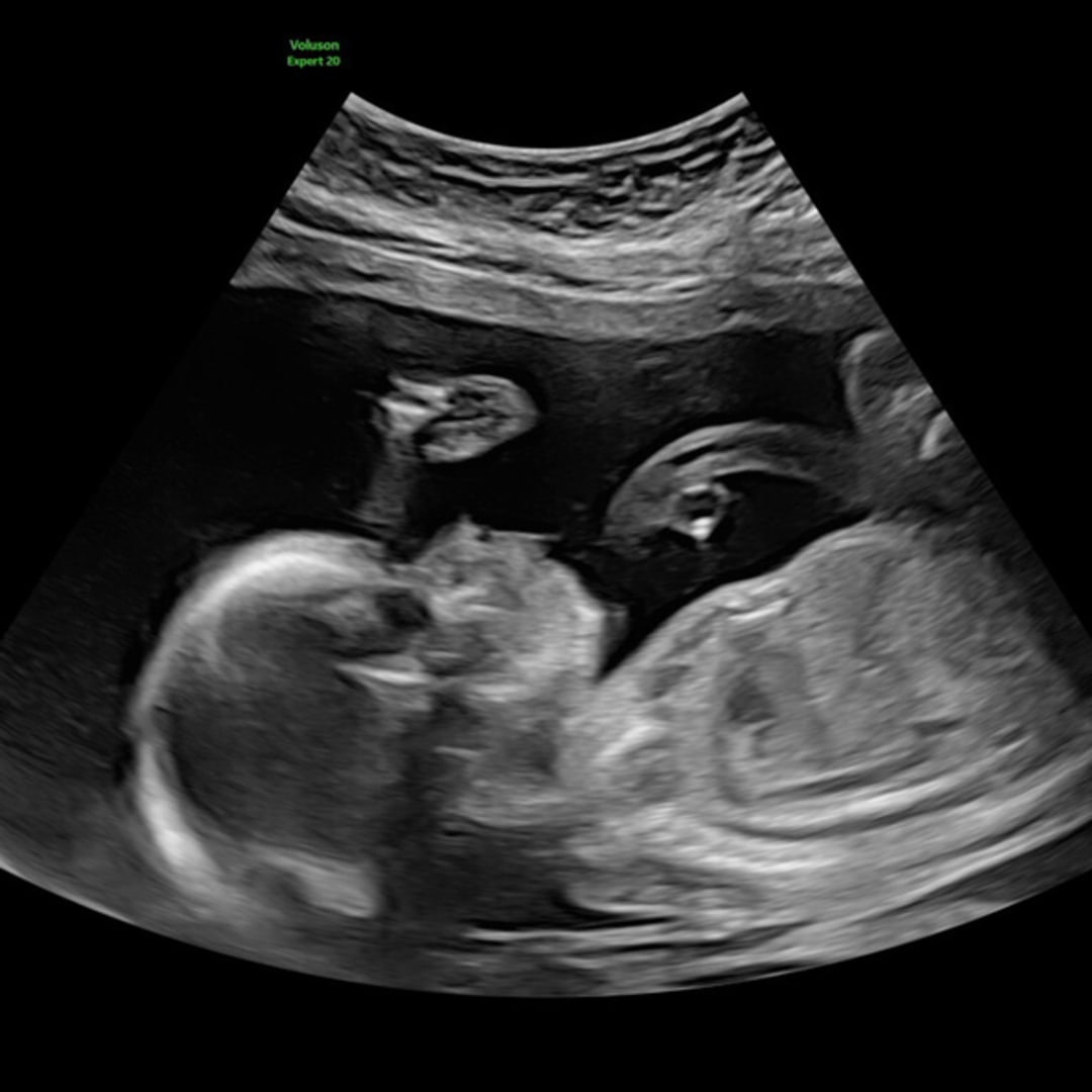 Photo shared by Taschia for their Babylist baby registry.