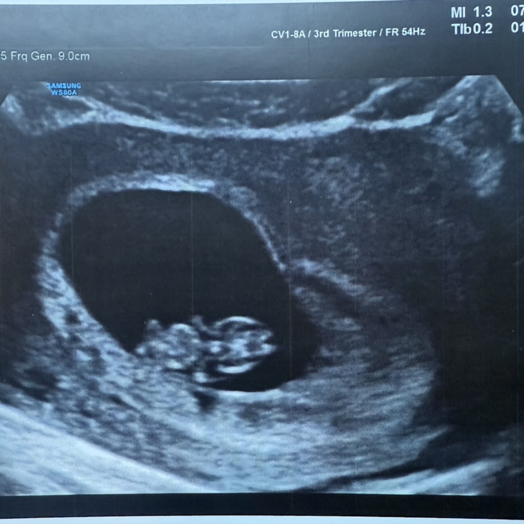 Photo shared by Brittany for their Babylist baby registry.
