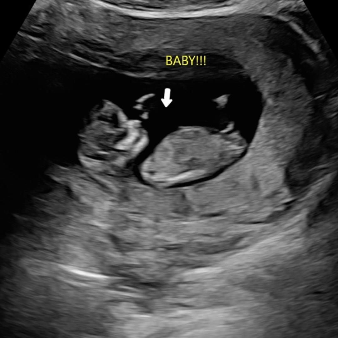 Photo shared by Ariadna for their Babylist baby registry.