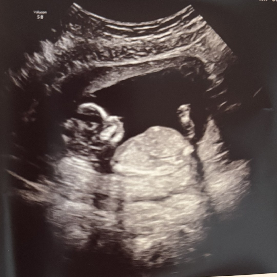 Photo shared by Halie for their Babylist baby registry.