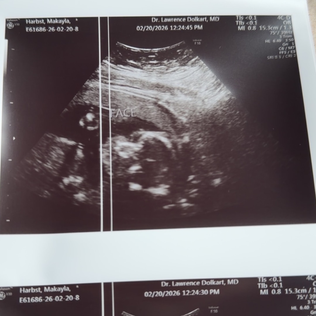 Photo shared by Makayla for their Babylist baby registry.